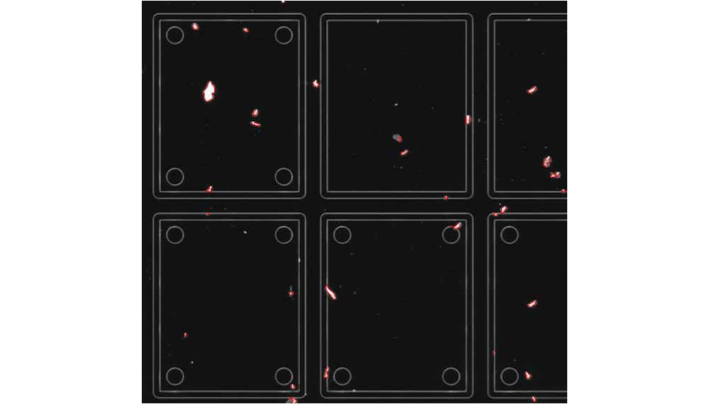 画像：暗視野検査